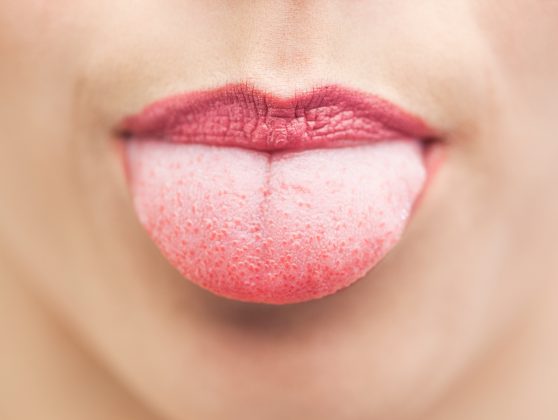 Causes And How To Treat Cut On Tongue Yabibo