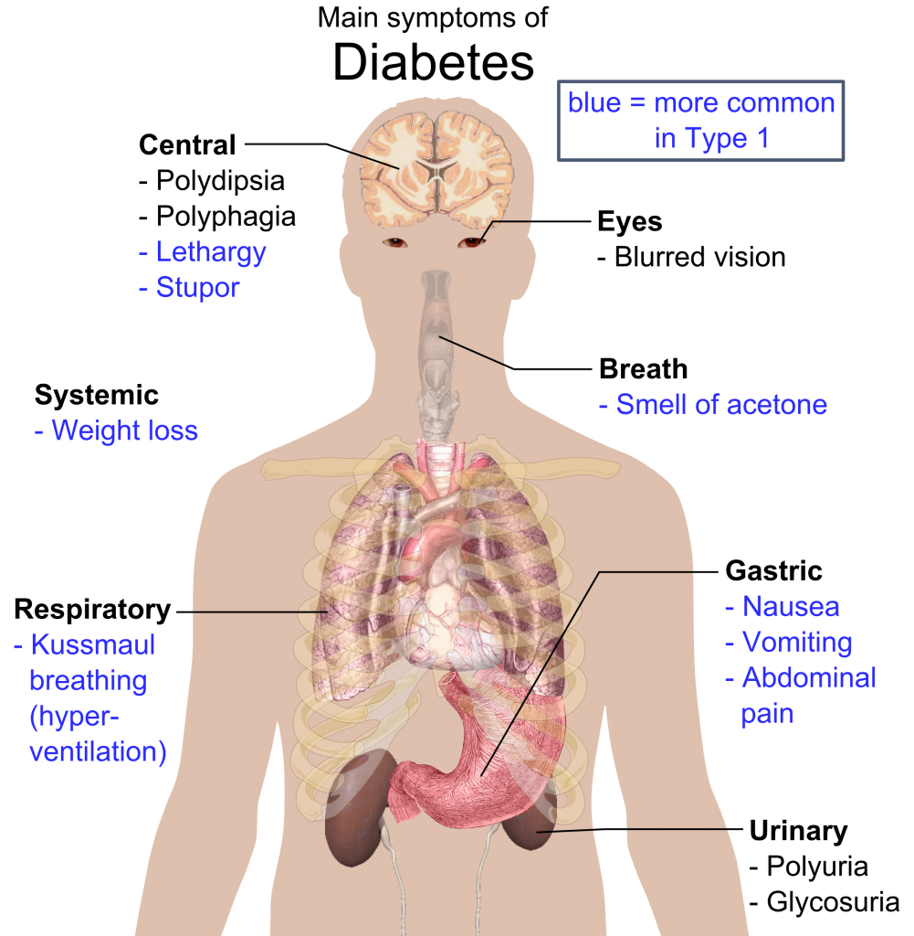 a-promising-treatment-for-type-1-diabetes-curious-times