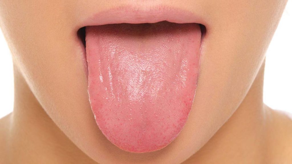 causes-and-how-to-treat-cut-on-tongue-yabibo